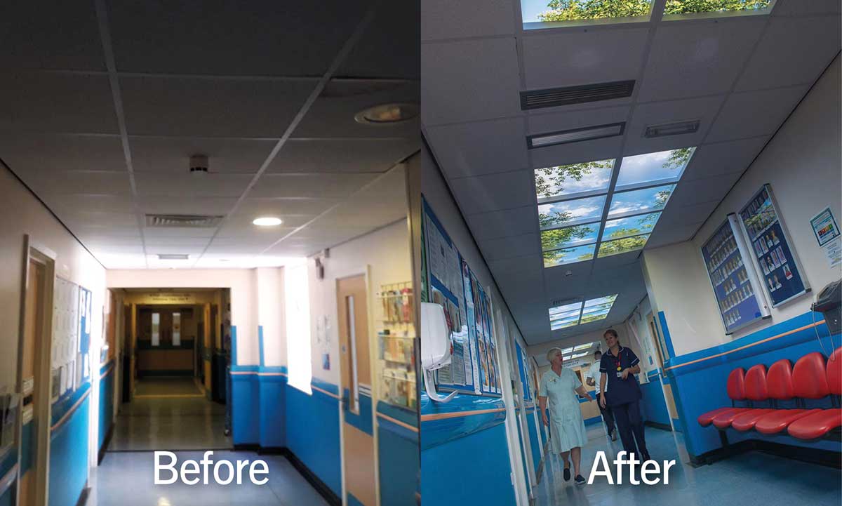 Before picture showing a dreary hospital corridor next to a more aesthetically pleasing after photo with LED ceiling lights.